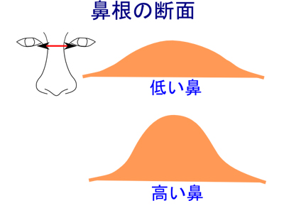 低い鼻と高い鼻の鼻根の断面