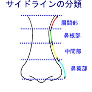 鼻のサイドラインの分類