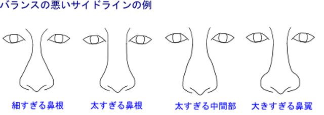 バランスの悪い鼻のサイドラインの例