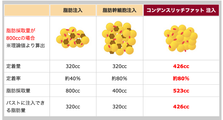 コンデンスリッチファット注入