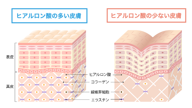 ヒアルロン酸